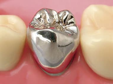 向ヶ丘遊園、登戸の歯医者、近藤歯科の料金表