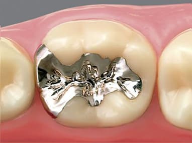 向ヶ丘遊園、登戸の歯医者、近藤歯科の料金表