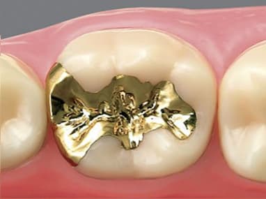 向ヶ丘遊園、登戸の歯医者、近藤歯科の料金表