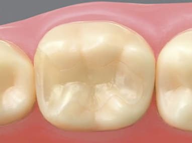 向ヶ丘遊園、登戸の歯医者、近藤歯科の料金表