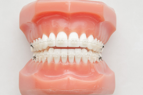 向ヶ丘遊園、登戸の歯医者、近藤歯科の矯正歯科