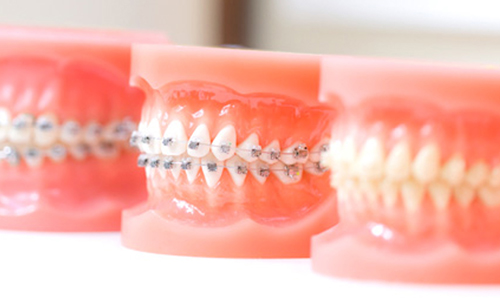 向ヶ丘遊園、登戸の歯医者、近藤歯科の矯正歯科