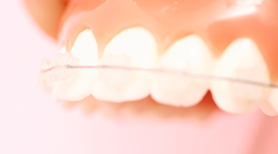 向ヶ丘遊園、登戸の歯医者、近藤歯科の矯正歯科