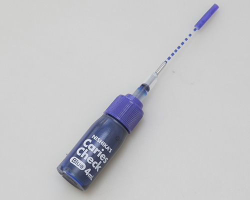 向ヶ丘遊園、登戸の歯医者、近藤歯科のMI治療