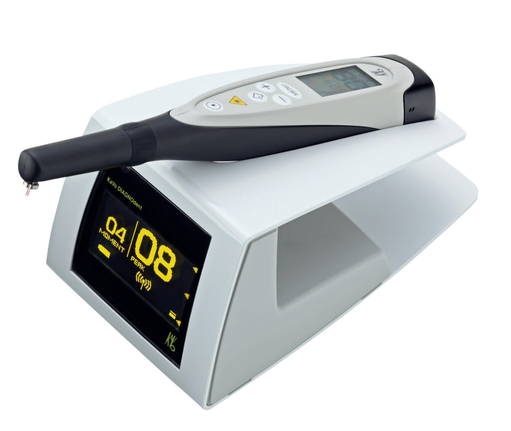 向ヶ丘遊園、登戸の歯医者、近藤歯科のMI治療