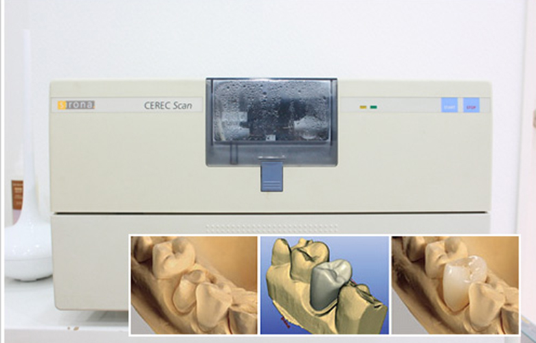 向ヶ丘遊園、登戸の歯医者、近藤歯科のセレック