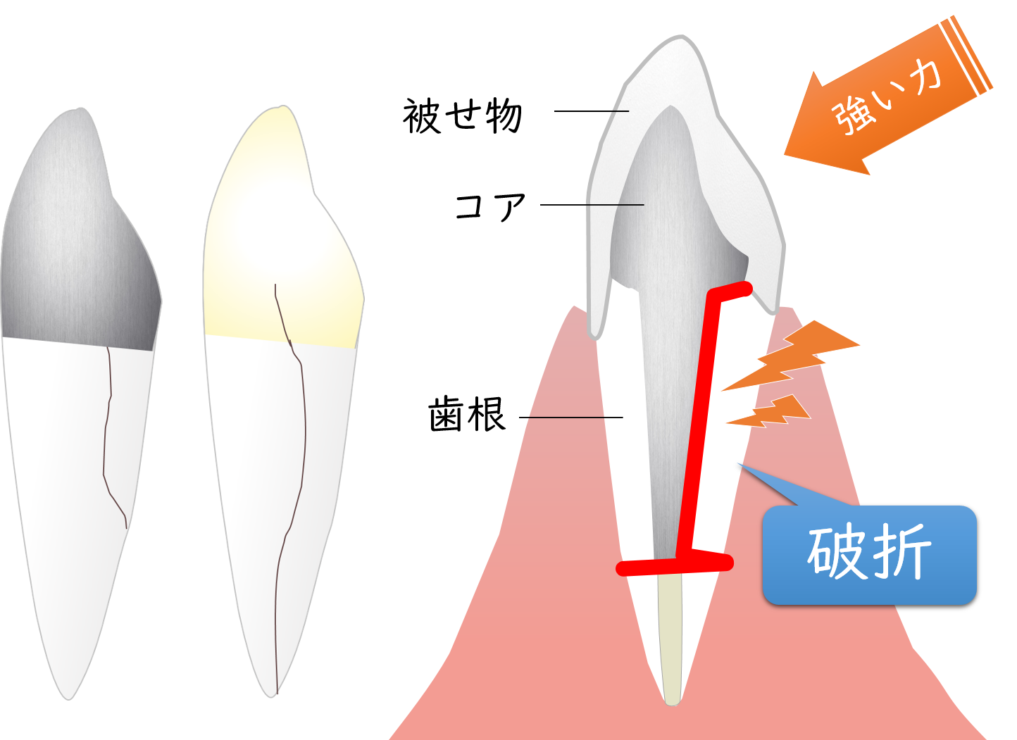 向ヶ丘遊園、登戸の歯医者、近藤歯科で歯科用ＣＴ