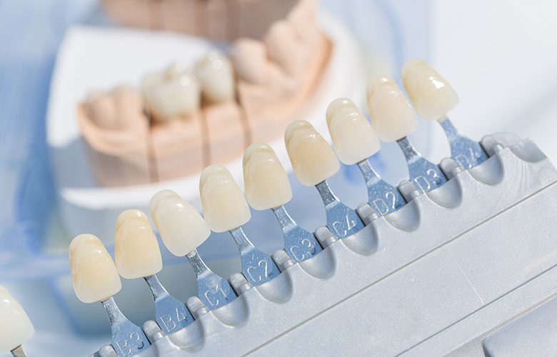 向ヶ丘遊園、登戸の歯医者、近藤歯科の審美歯科