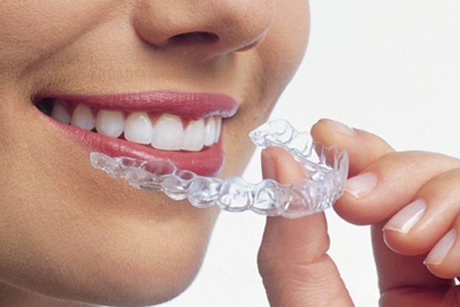 向ヶ丘遊園、登戸の歯医者、近藤歯科の矯正歯科