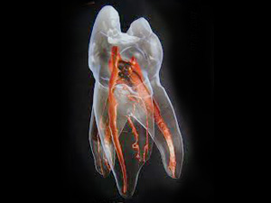 向ヶ丘遊園、登戸の歯医者、近藤歯科で歯科用ＣＴ