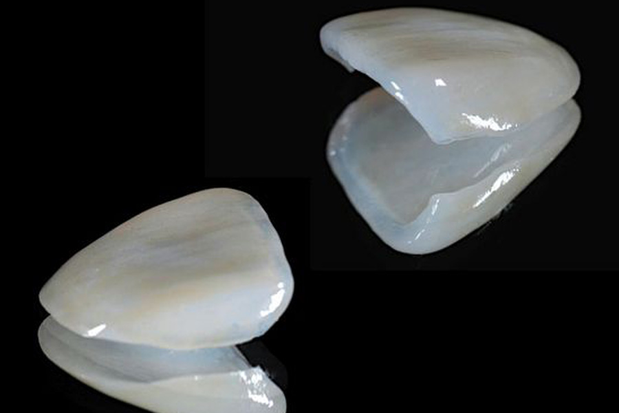 向ヶ丘遊園、登戸の歯医者、近藤歯科の審美歯科