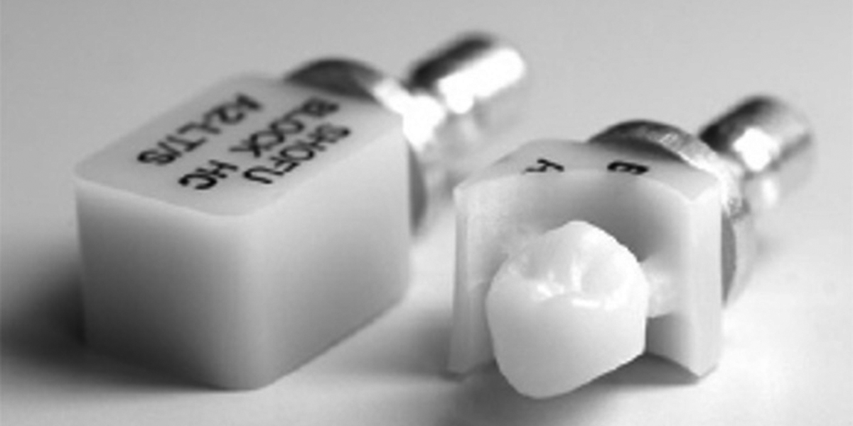 保険適用の白い歯