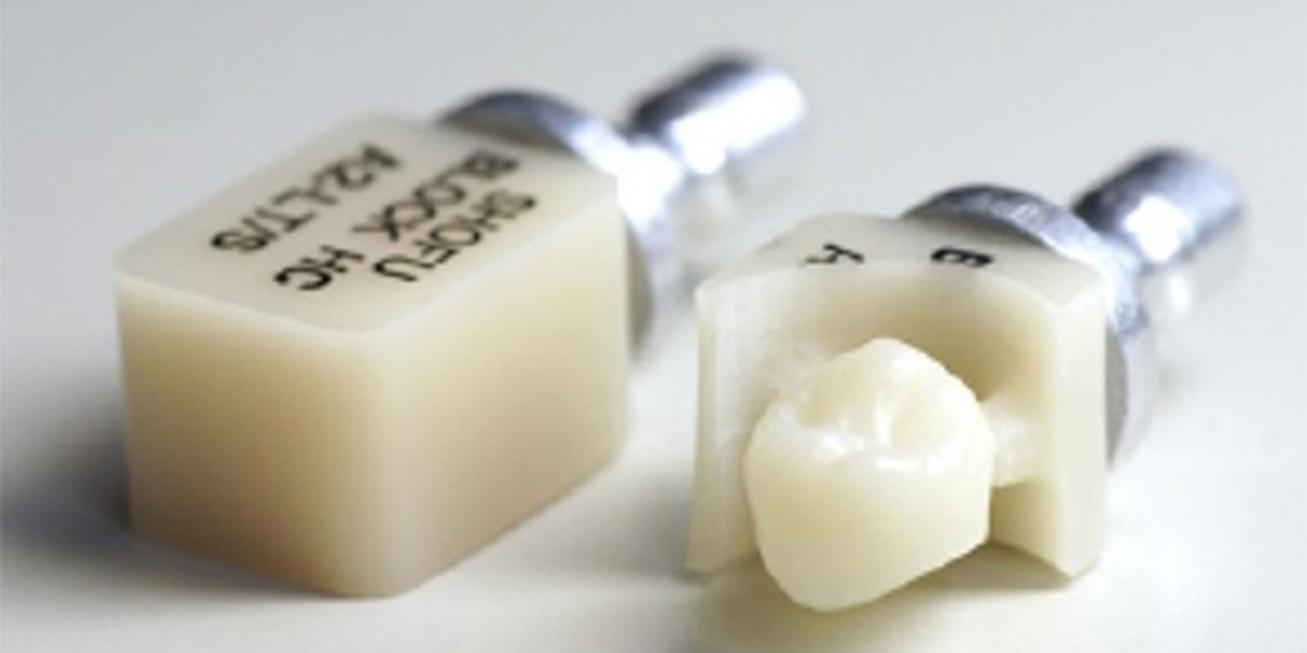 保険適用の白い歯