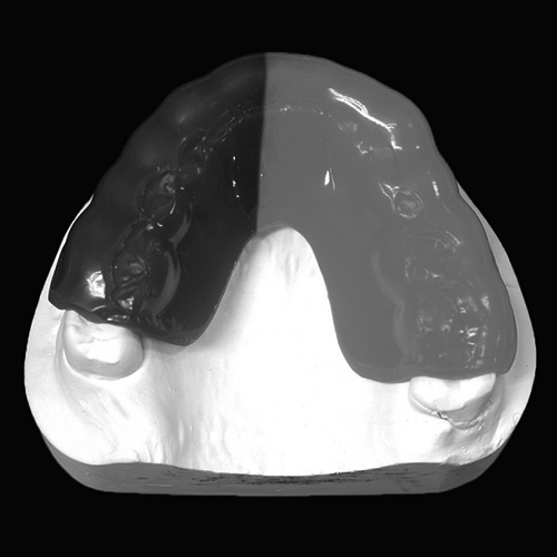 スポーツマウスピース