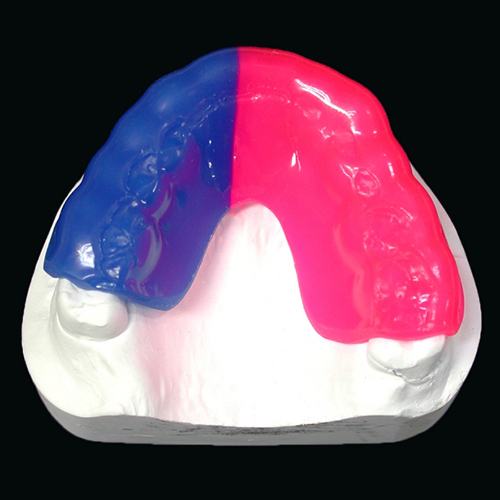 スポーツマウスピース