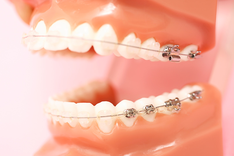 向ヶ丘遊園、登戸の歯医者、近藤歯科の親知らずの抜歯