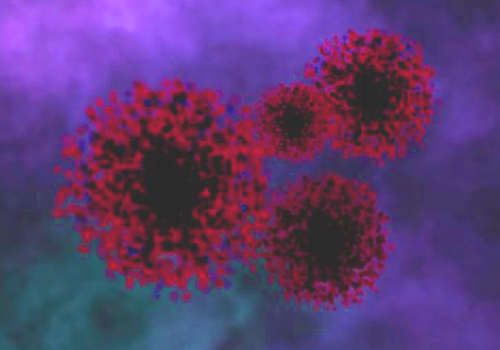 向ヶ丘遊園、登戸の歯医者、近藤歯科の親知らずの抜歯