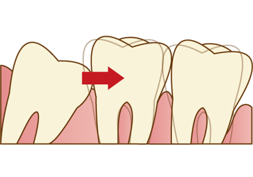向ヶ丘遊園、登戸の歯医者、近藤歯科の親知らずの抜歯