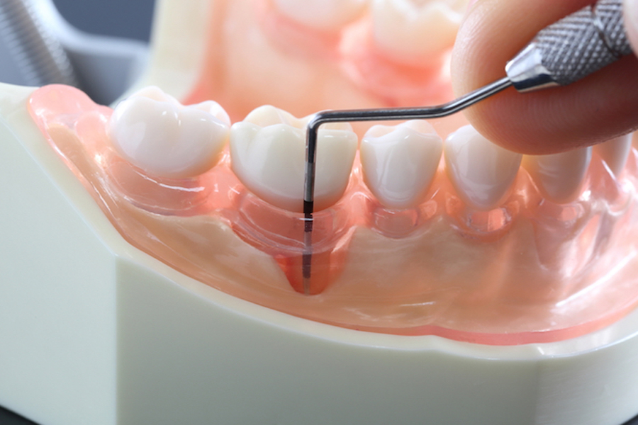 向ヶ丘遊園、登戸の歯医者、近藤歯科で予防歯科