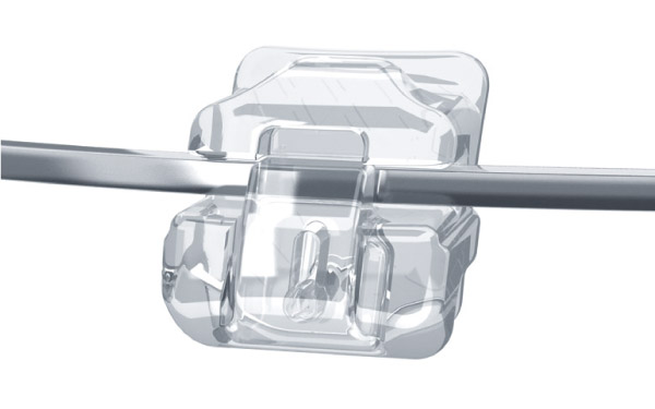 向ヶ丘遊園、登戸の歯医者、近藤歯科の矯正歯科