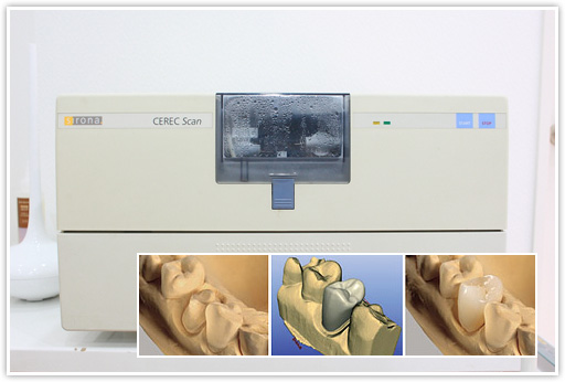 向ヶ丘遊園、登戸の歯医者、近藤歯科で即日セレック(CEREC)治療
