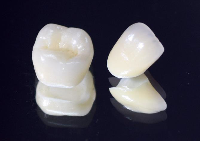 向ヶ丘遊園、登戸の歯医者、近藤歯科の料金表