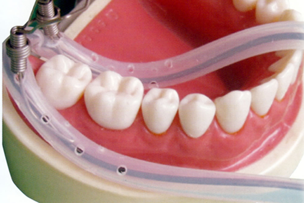 向ヶ丘遊園、登戸の歯医者、近藤歯科で根管治療